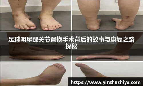 足球明星踝关节置换手术背后的故事与康复之路探秘